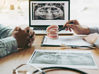 Dental consultation scene with a professional pointing at a tooth model using a pen, while the patient listens attentively. The table holds a clipboard, stethoscope, and printed dental X-ray, with a laptop in the background displaying a panoramic X-ray for diagnostic discussion.